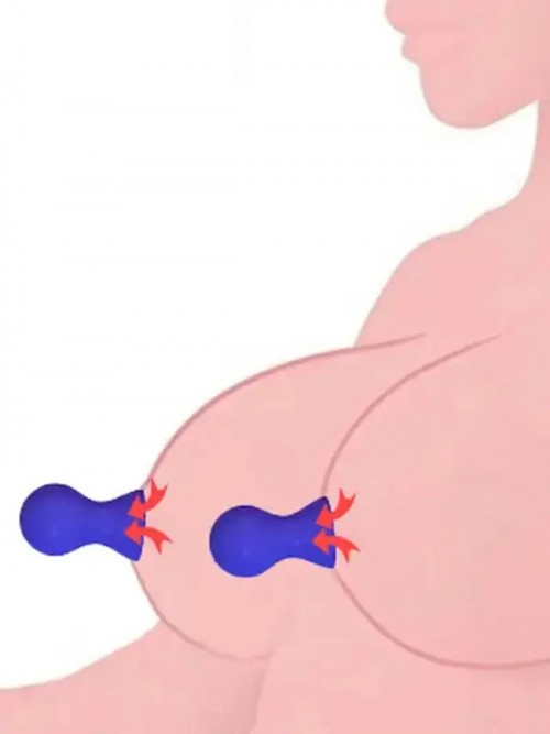 NOXXX Nipple Suckers Göğüc Ucu ve Klitoris Pompası Siyah 3